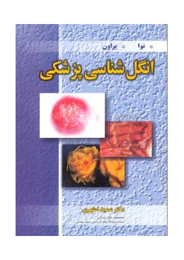 material_2_1469868382